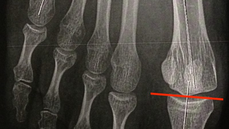 免维护电瓶充电器：如何正确使用与维护**